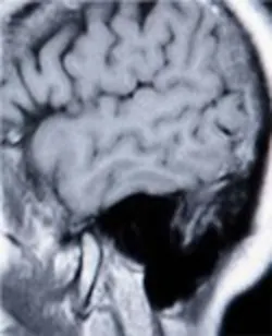 033 Hci0901 Ufig9 033 Hci0901 Ufig9