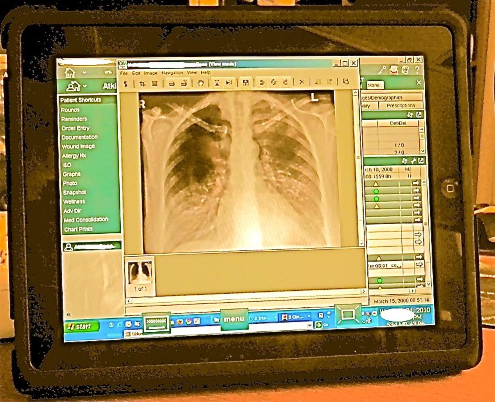 Qcpr On Ipad No Commercial References Medium