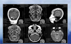 030 Hci1009 Ufig5 030 Hci1009 Ufig5