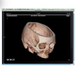 Hmt1104 Himss Prods 179 Hmt1104 Himss Prods 179