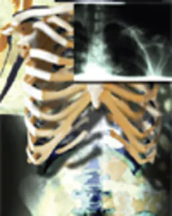 Hmt 201108 Industry Watch Imaging Hmt 201108 Industry Watch Imaging