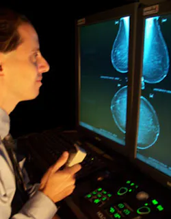 Digital Mammo 1 Digital Mammo 1