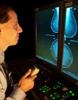 Digital Mammo 1 Digital Mammo 1