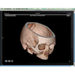 Hmt 201111 Imaging Products Fujifilm Synapse Mobility Hmt 201111 Imaging Products Fujifilm Synapse Mobility