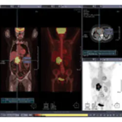 Hmt 201111 Imaging Products Infinitt Colo Cad Hmt 201111 Imaging Products Infinitt Colo Cad