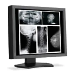 Hmt 201111 Imaging Products Ne Cdisplay Md215 Mg Hmt 201111 Imaging Products Ne Cdisplay Md215 Mg
