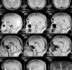 Mriimages1 Web 0 Mriimages1 Web 0