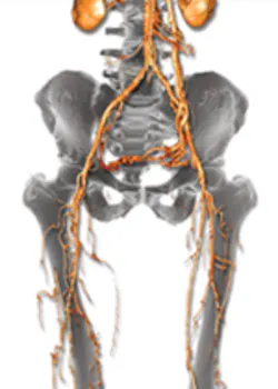 H05 Reg Products Vital Images Vitrea H05 Reg Products Vital Images Vitrea