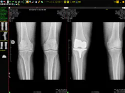 H11 Imaging Viztek Ortho Opal H11 Imaging Viztek Ortho Opal