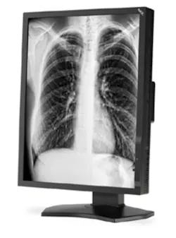 H11 Imaging Nec Multi Sync H11 Imaging Nec Multi Sync