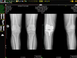 H11 Imaging Viztek Ortho Opal H11 Imaging Viztek Ortho Opal