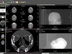 H11 Pacs Ris Viztek H11 Pacs Ris Viztek