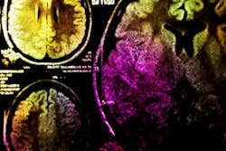 12706704 S 12706704 S