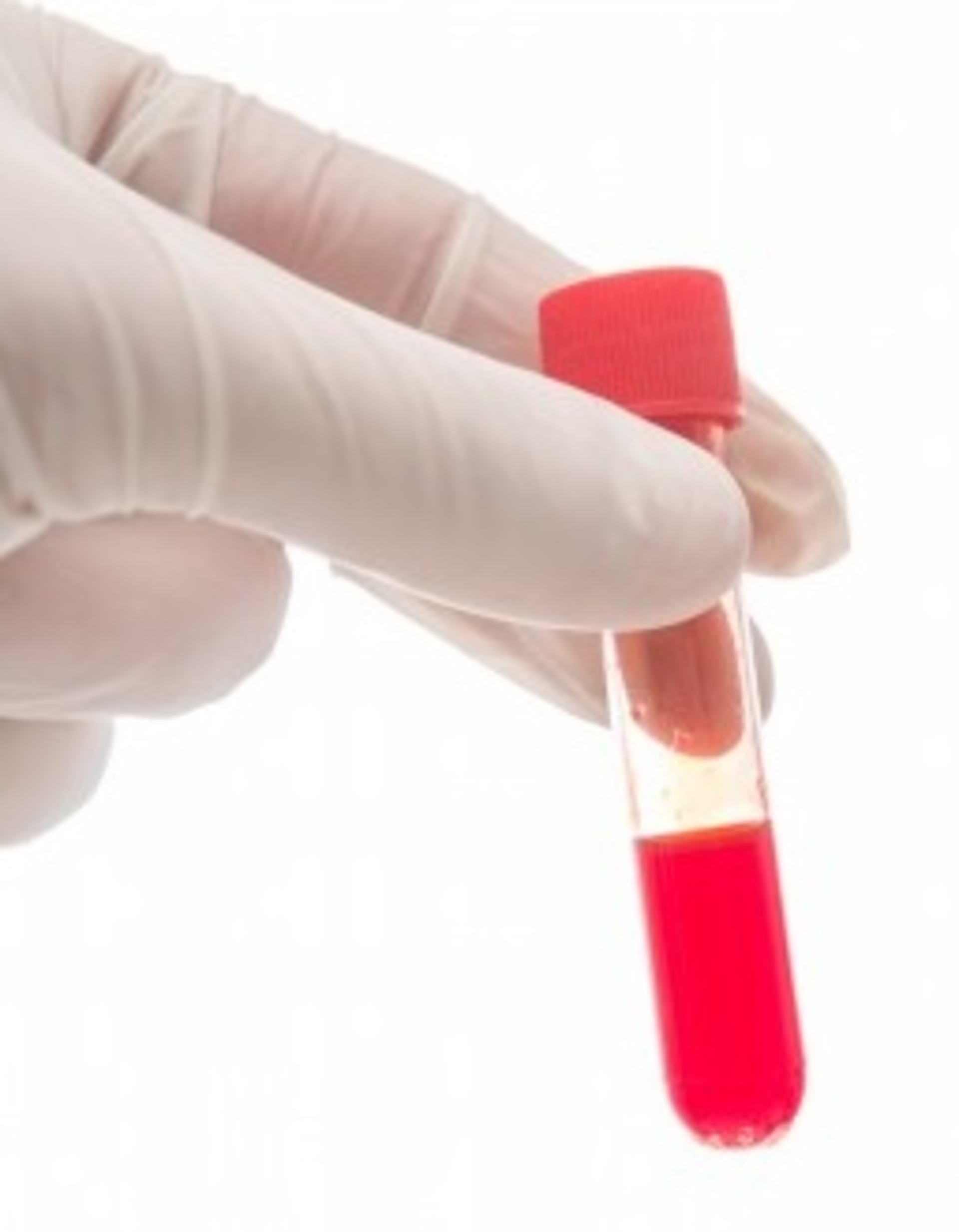 Bloodvial 18117969 S