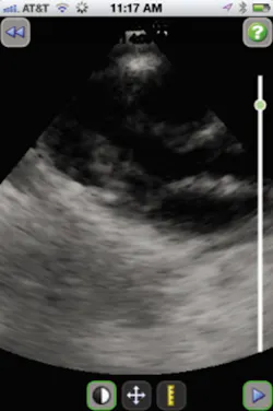 H05 Sg Pacs Ris Bri Tsy Opt H05 Sg Pacs Ris Bri Tsy Opt