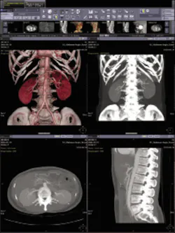 H05 Sg Pacs Ris Infini Opt H05 Sg Pacs Ris Infini Opt