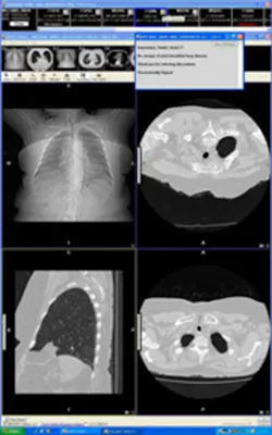 H1406 Dash Co Activ Exampacs H1406 Dash Co Activ Exampacs