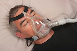 Sleep Apnea Sleep Apnea