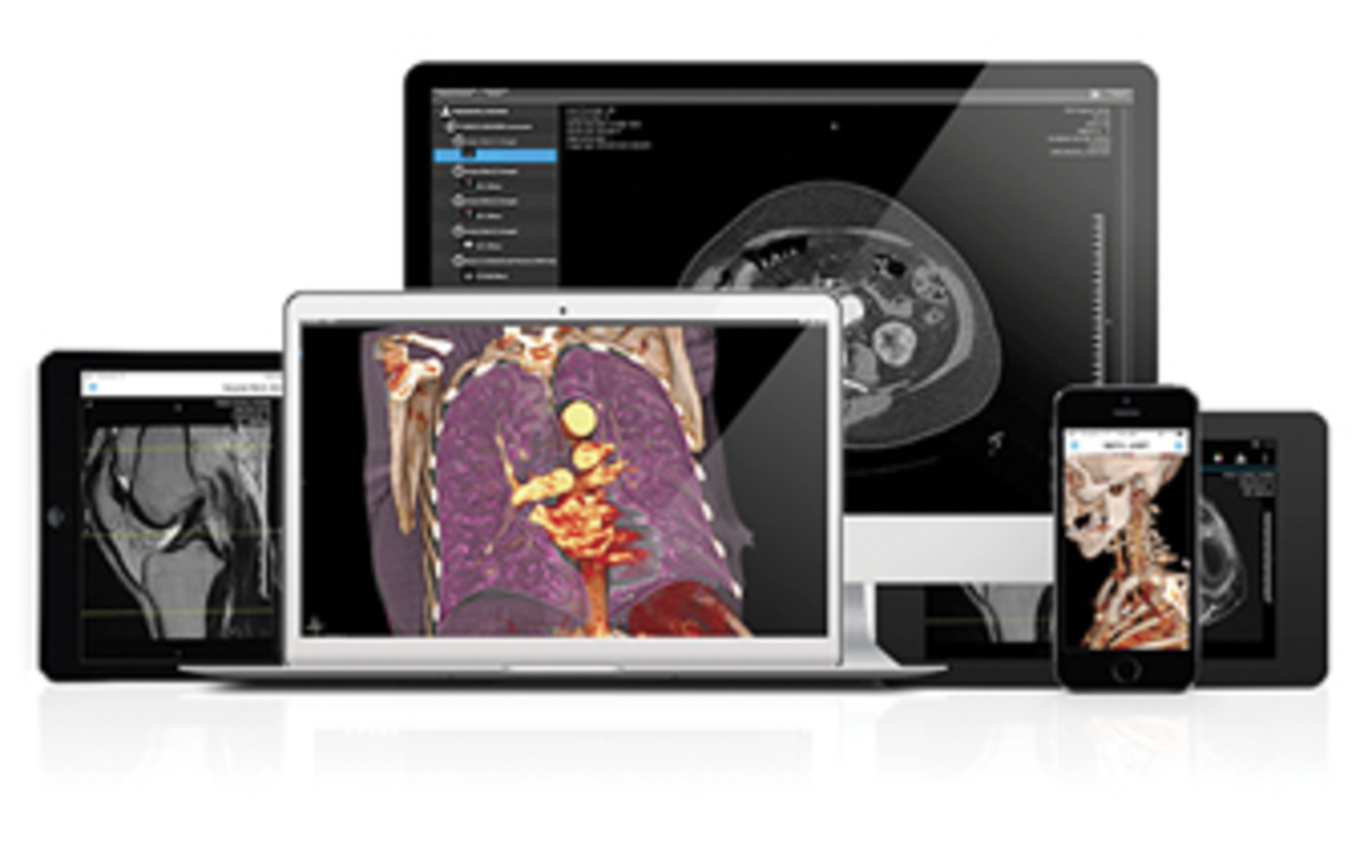 H1412 New Products Hyland Onbase Calgary2