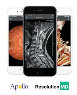 H1511 Solutions Imaging Apollo Res Md 293x357 H1511 Solutions Imaging Apollo Res Md 293x357