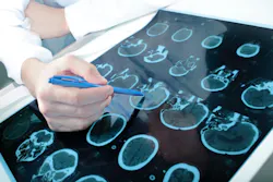 Parkinsons Parkinsons