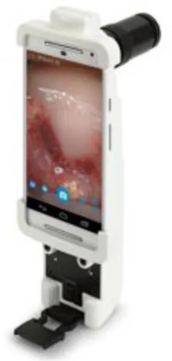 Mobileodt 112x235 Mobileodt 112x235