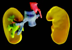 H05toptech Stratasys Va Kidney H05toptech Stratasys Va Kidney