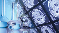 H11 12 Products Pacs Img Aspyra H11 12 Products Pacs Img Aspyra