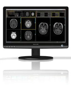 H11 12 Products Pacs Img Intelerad 298x357 H11 12 Products Pacs Img Intelerad 298x357