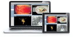 H11 12 Products Pacs Img Novarad H11 12 Products Pacs Img Novarad