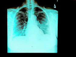 Dreamstime Xl 176556178 5ef20be75bd25 Dreamstime Xl 176556178 5ef20be75bd25