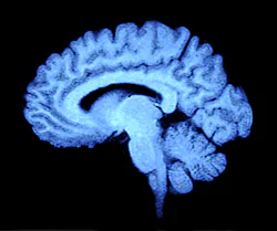 Dreamstime S 4963114 619e92308eef5 Dreamstime S 4963114 619e92308eef5