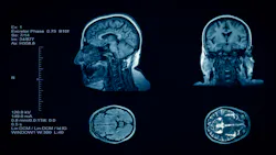 Dreamstime S 174049017 61c602830d521 Dreamstime S 174049017 61c602830d521