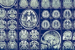 Dreamstime L 106000883 63348039b8e79 Dreamstime L 106000883 63348039b8e79