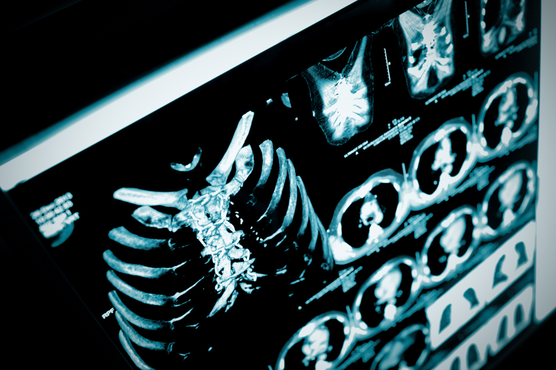 At RSNA, Experts Warn of Danger from Malicious Use of AI Against