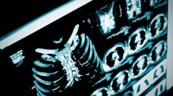 Dreamstime S 56972829 Dreamstime S 56972829