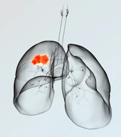 6557dd93831b38001ebe0b53 Dreamstime Xxl 137231100 6557dd93831b38001ebe0b53 Dreamstime Xxl 137231100