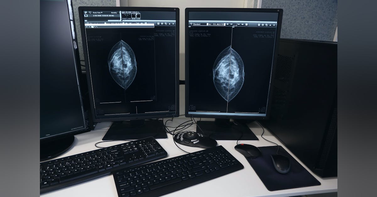 Research: Self-Scheduling Boosts Mammogram Completion Rates Research: Self-Scheduling Boosts Mammogram Completion Rates