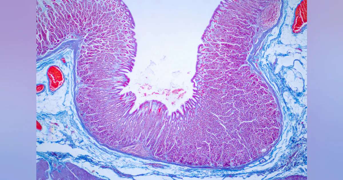 It’s Time for a New Option in Colorectal Cancer Screening It’s Time for a New Option in Colorectal Cancer Screening
