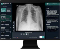 University Hospitals Cleveland Medical Center is comparing an algorithm's ability to detect pulmonary nodules to a radiologist’s interpretation of the same chest X-rays. University Hospitals Cleveland Medical Center is comparing an algorithm's ability to detect pulmonary nodules to a radiologist’s interpretation of the same chest X-rays.